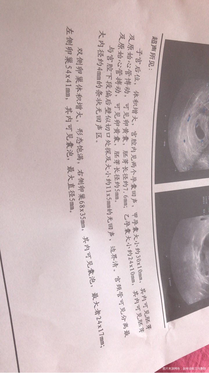 2017.10.29移植两枚鲜胚,一个⑧细胞二级,一个六细胞二级,移植十四天抽血...