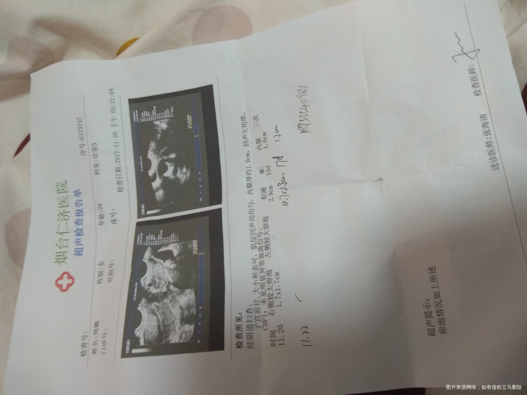 到底是啥时排的卵,我又晚了