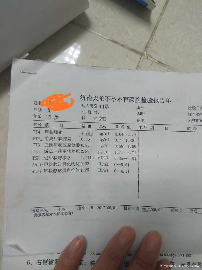 医生帮看看,这个问题大吗,