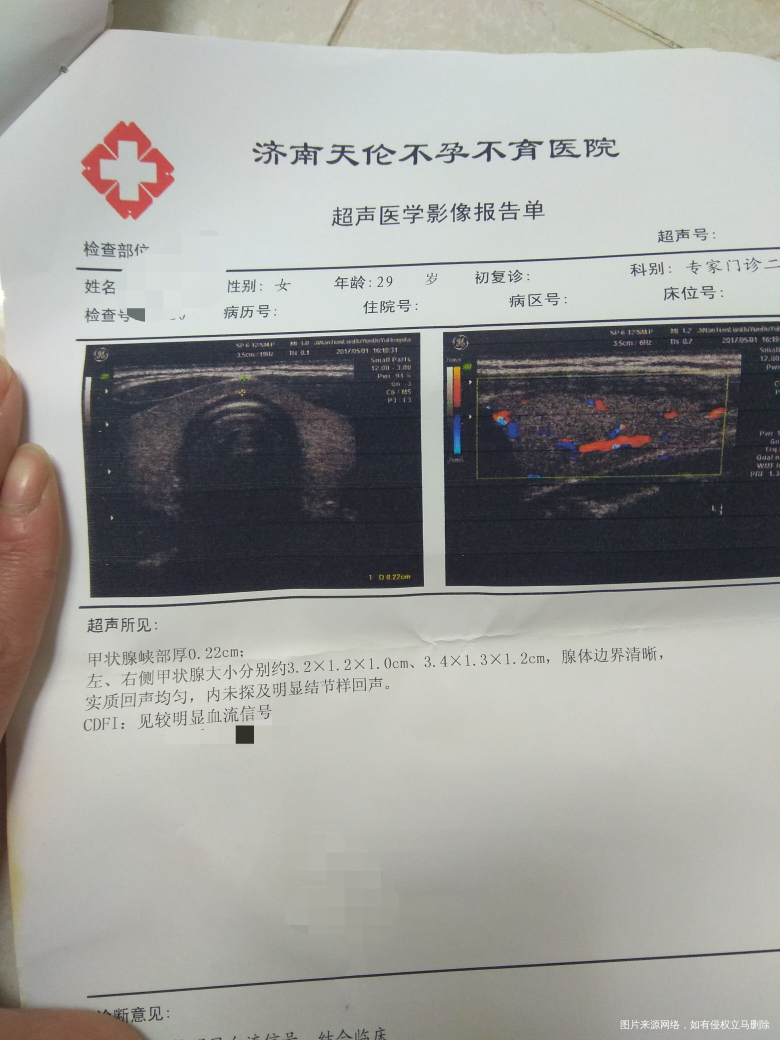 医生帮看看,这个问题大吗,