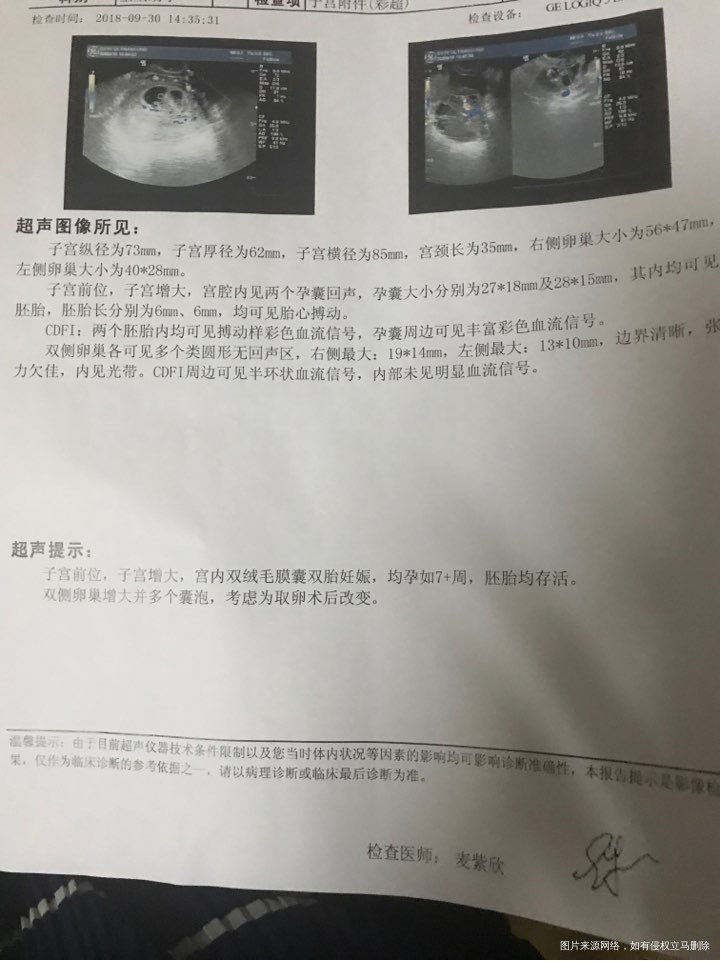 
一超回来,排队三个钟,开药一分钟,漫长的等待三个月安全期!加油