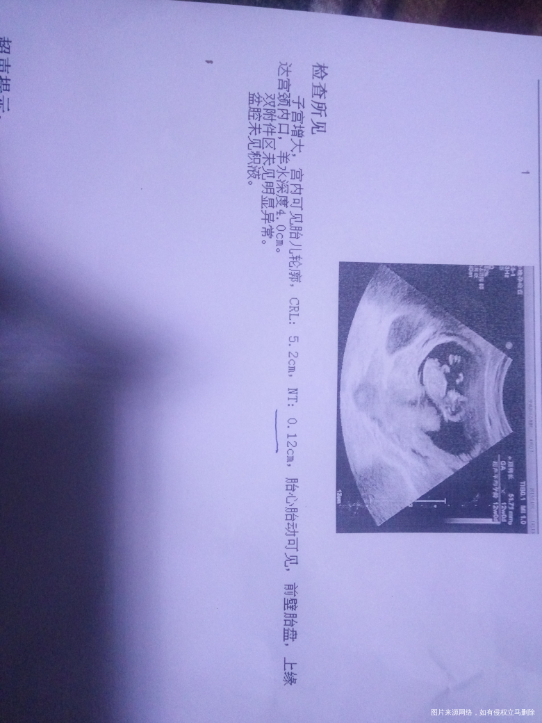 12周NT……………