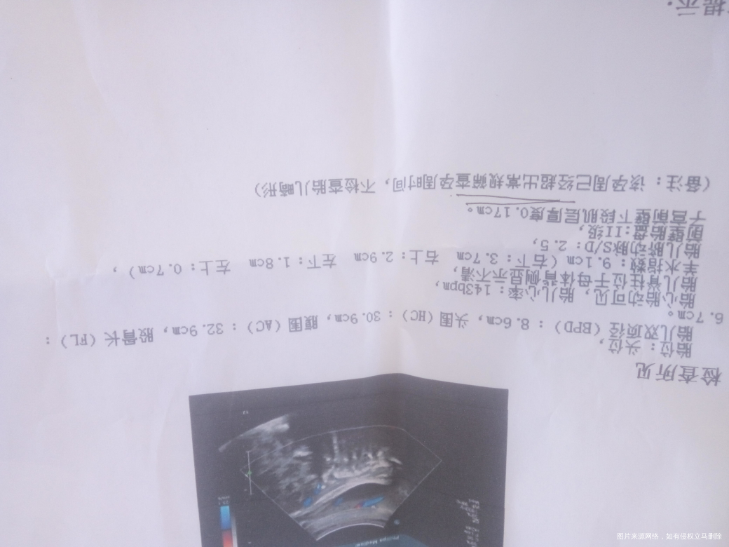 37周+1了,医生我的宝宝是不是偏小啊?胎儿脊柱位于母体背侧显示不清