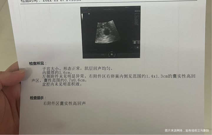 帮忙看看宫内还是宫外,谢谢