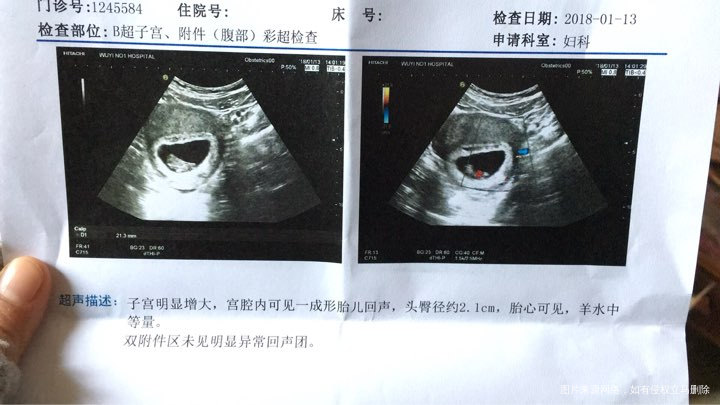 刚刚孕10周,早上出血了,有事吗?