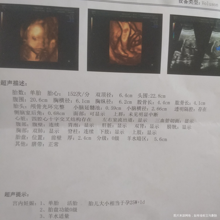 各项指标正常吗?能计算出胎儿的体重吗?,