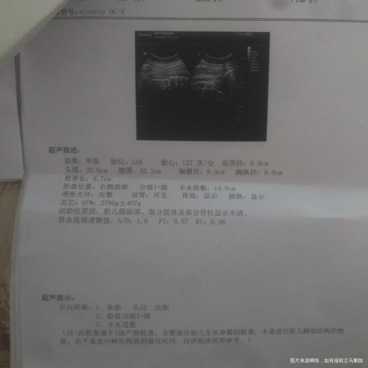 帮忙看看孩子入盆了吗