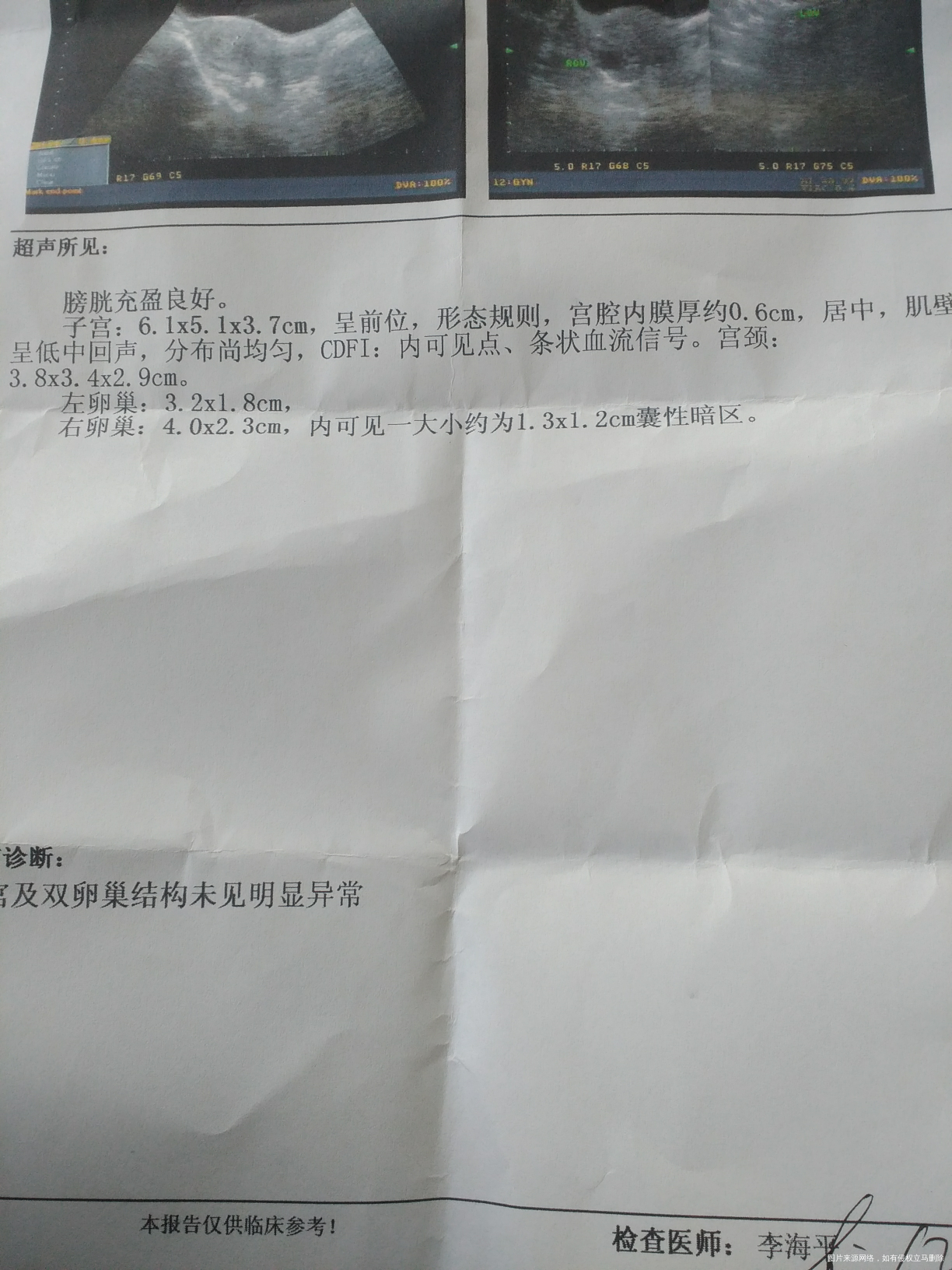 求助大夫生化后10天的b超单子