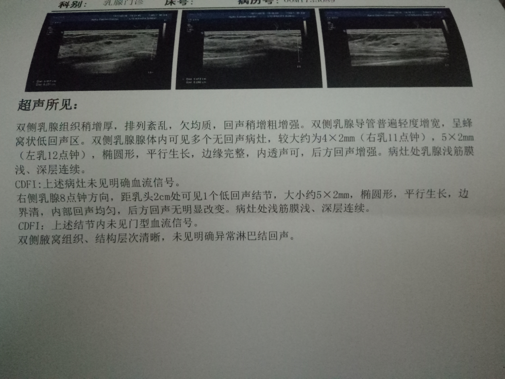 去年查乳腺彩超的报告,不知今年是否要去复查呢?