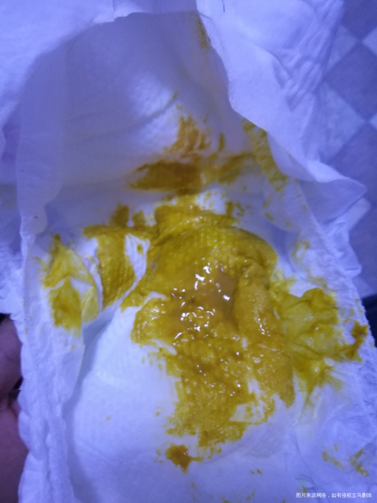 医生帮帮看一下宝宝的便便