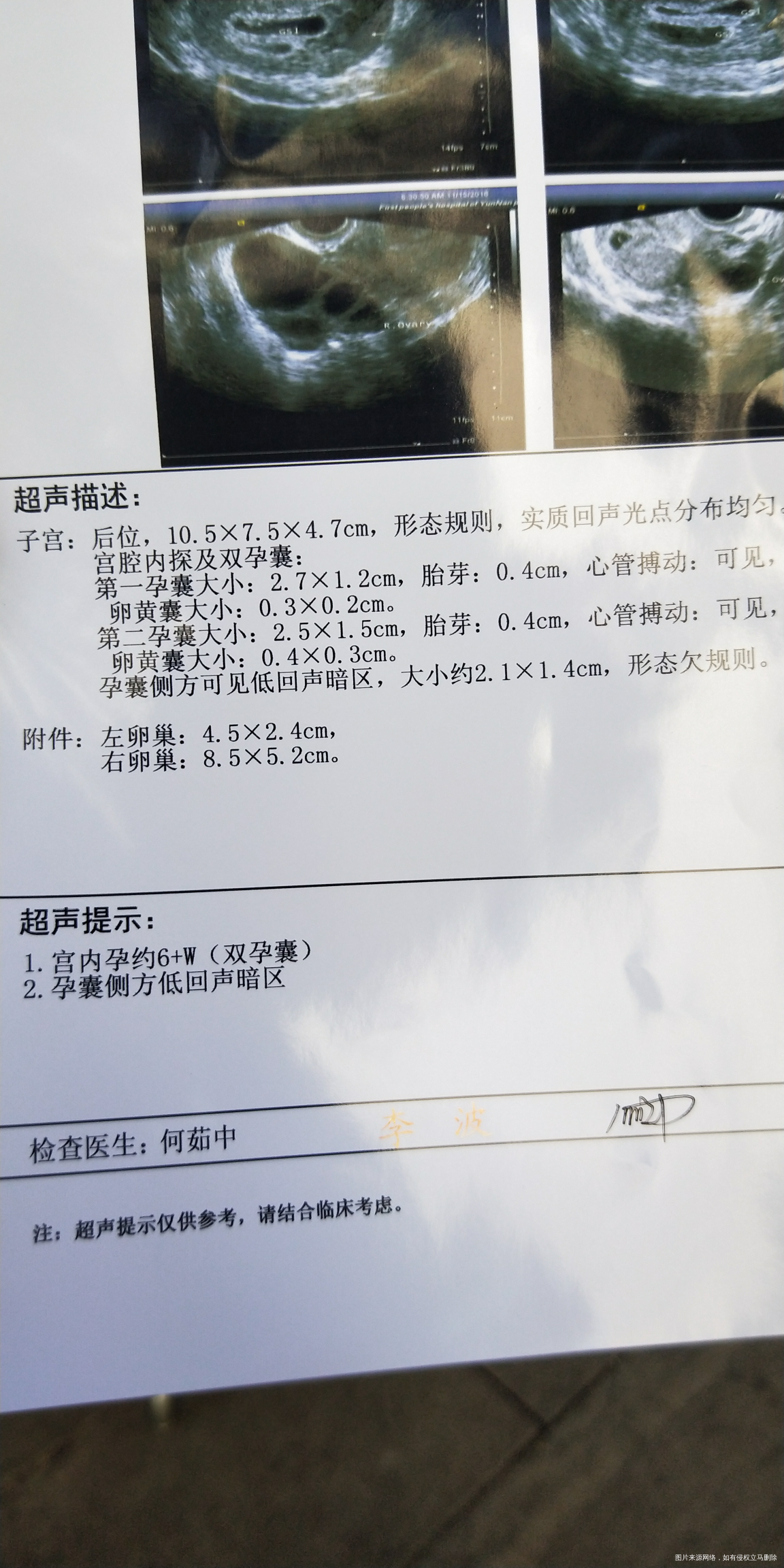 今天一超发现暗区,求助