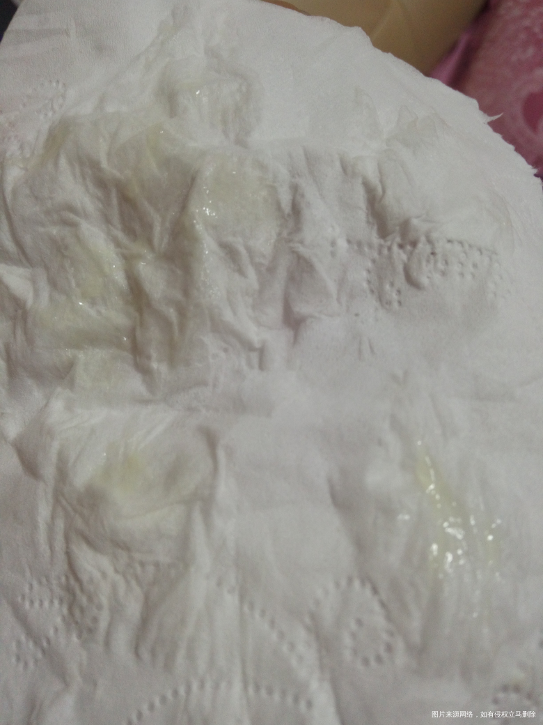 刚刚上卫生间小便,突然有一些像鸡蛋清一样的液体