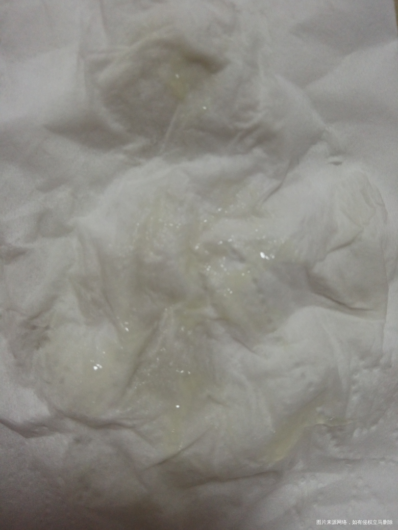 刚刚上卫生间小便,突然有一些像鸡蛋清一样的液体