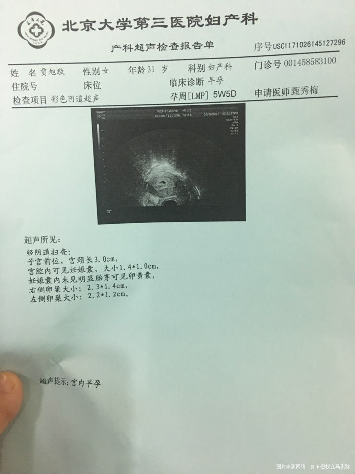 急急急,移植23天出血,医生帮忙看看