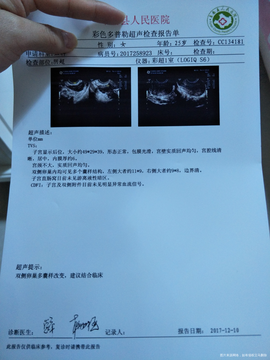 求问。这是多囊吗。还没见到医生