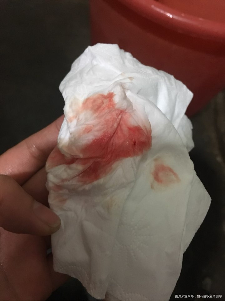 月经颜色请帮帮我看下正常吗