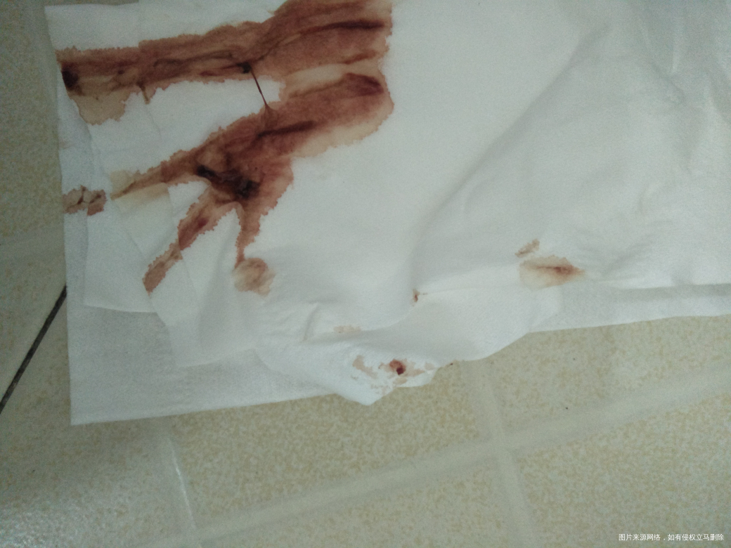 姐妹们你们有没有这个情况,进来聊聊,急急急