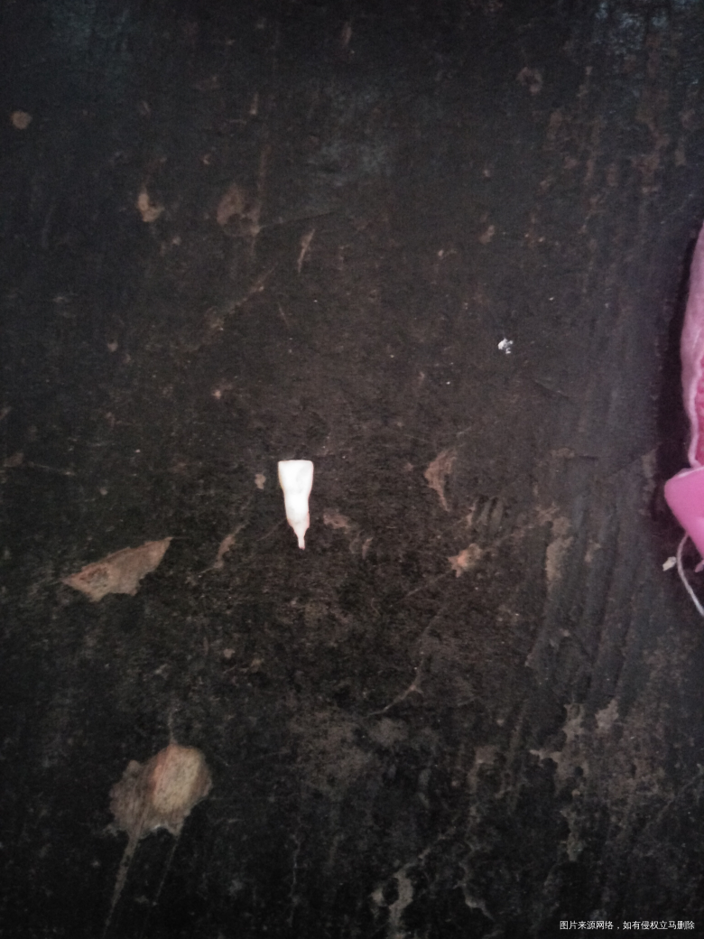 请问医生四岁宝宝牙掉了正常吗?