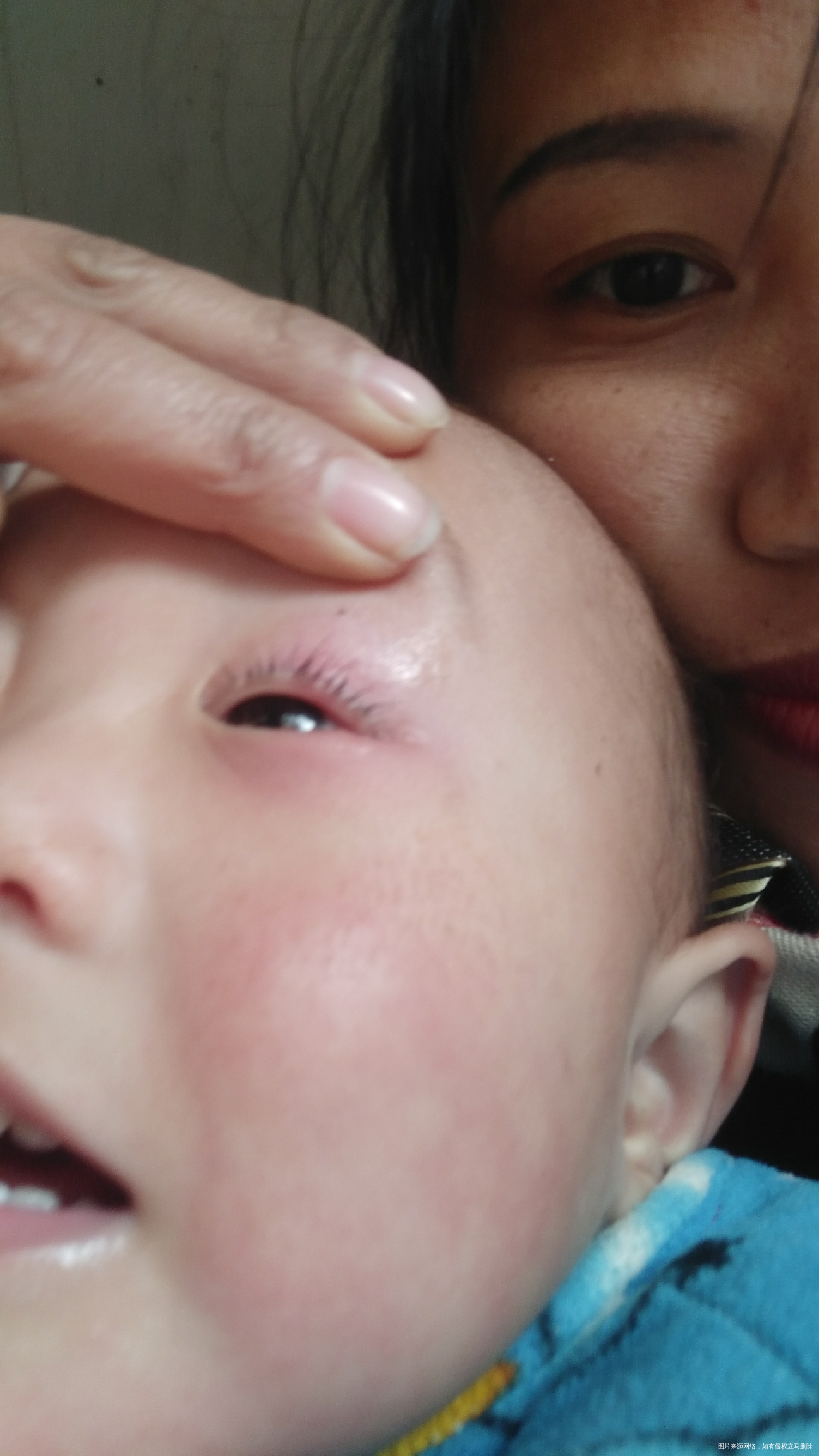 宝宝眼睛这样是怎么回事