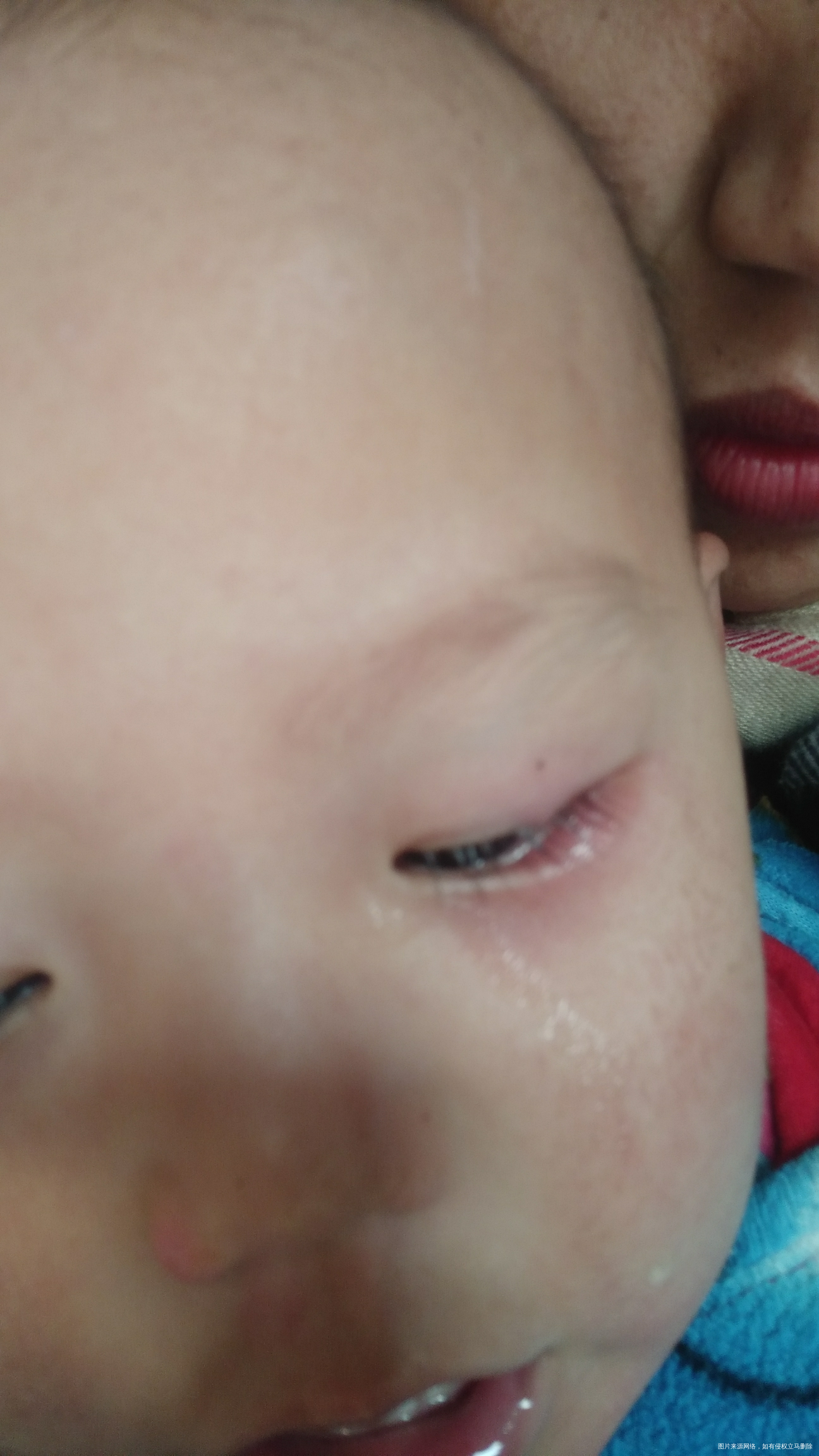 宝宝眼睛这样是怎么回事