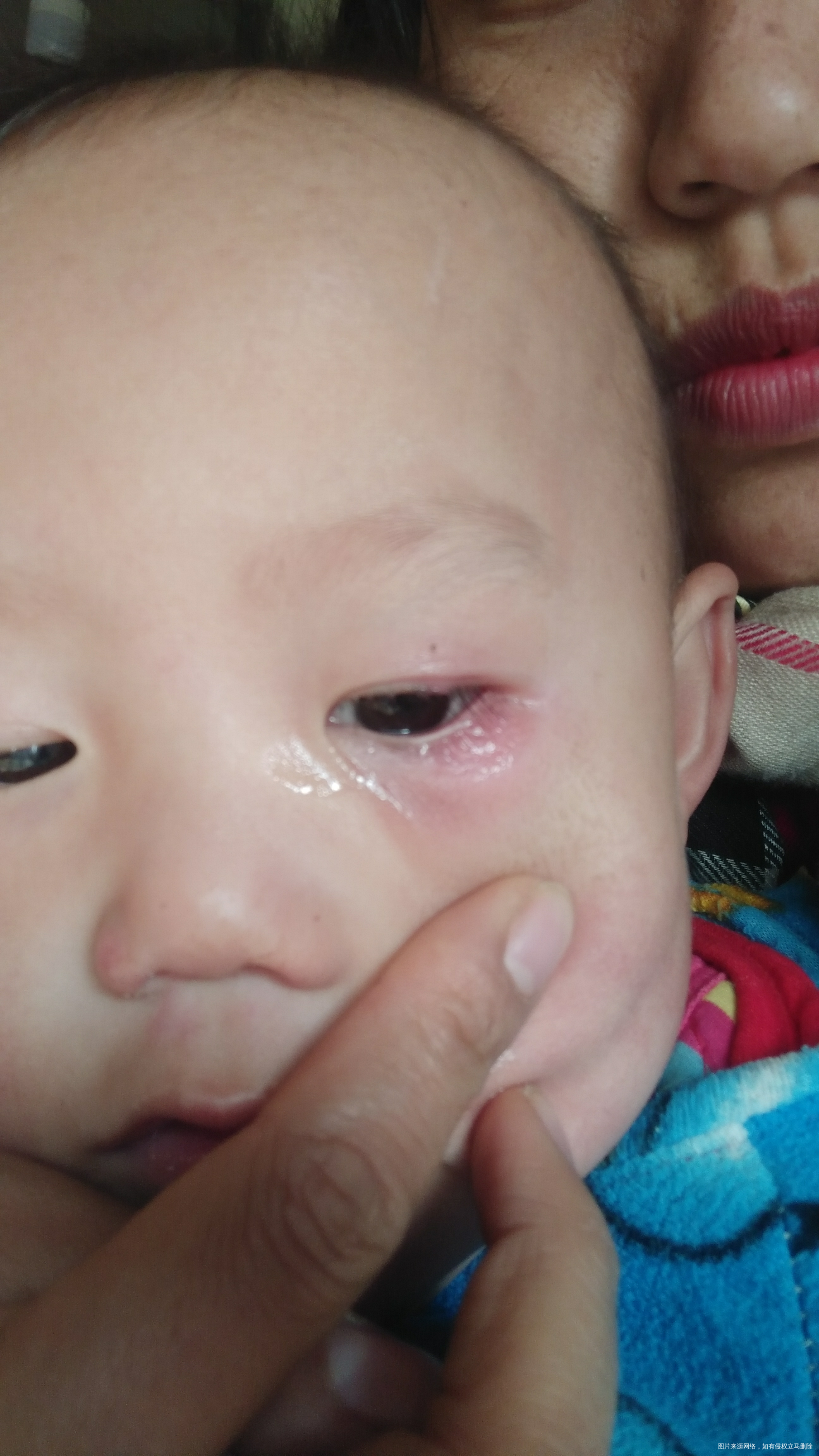 宝宝眼睛这样是怎么回事