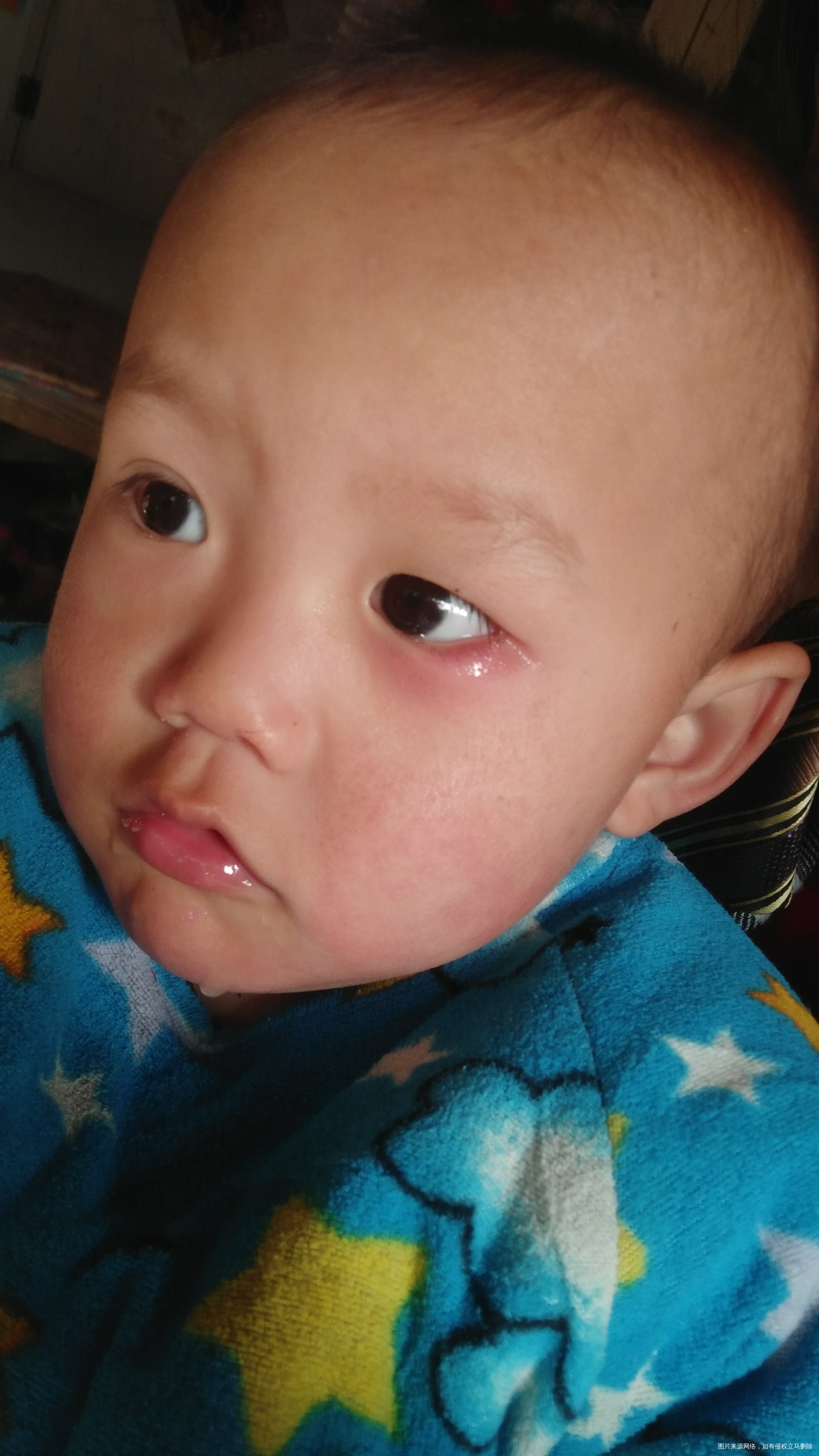 宝宝眼睛这是怎么回事,姐妹们你们宝宝有过这样的情况吗