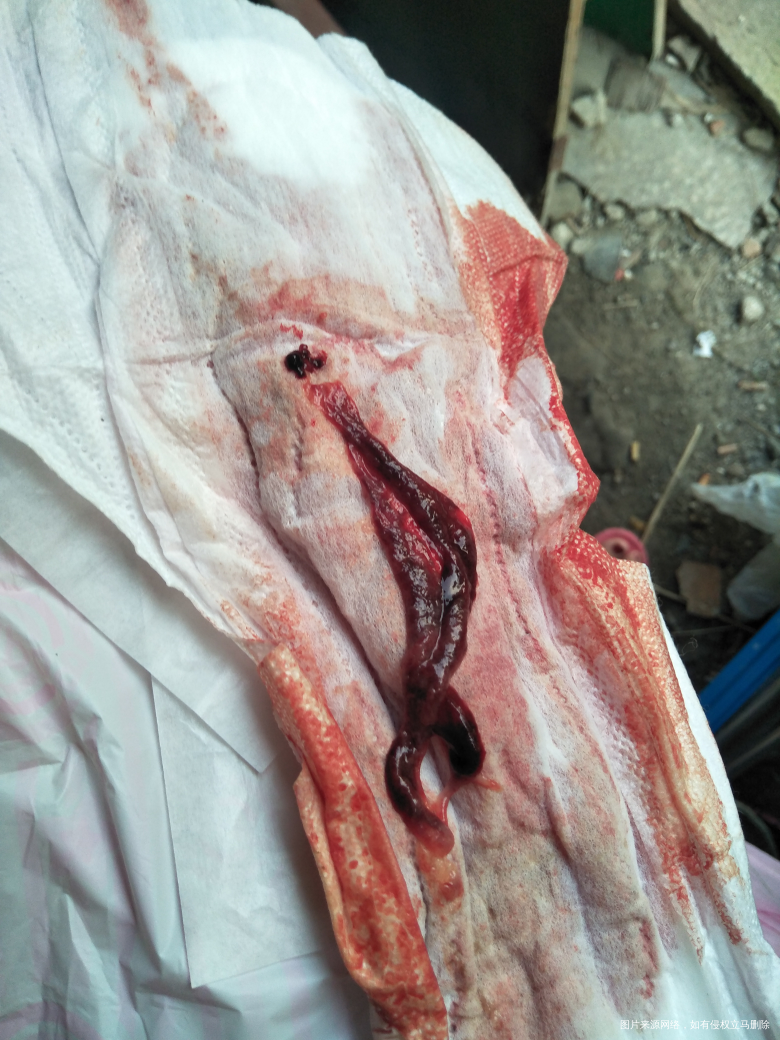 姐妹们帮看看这个是啥,月经排出来的,好大一个东西