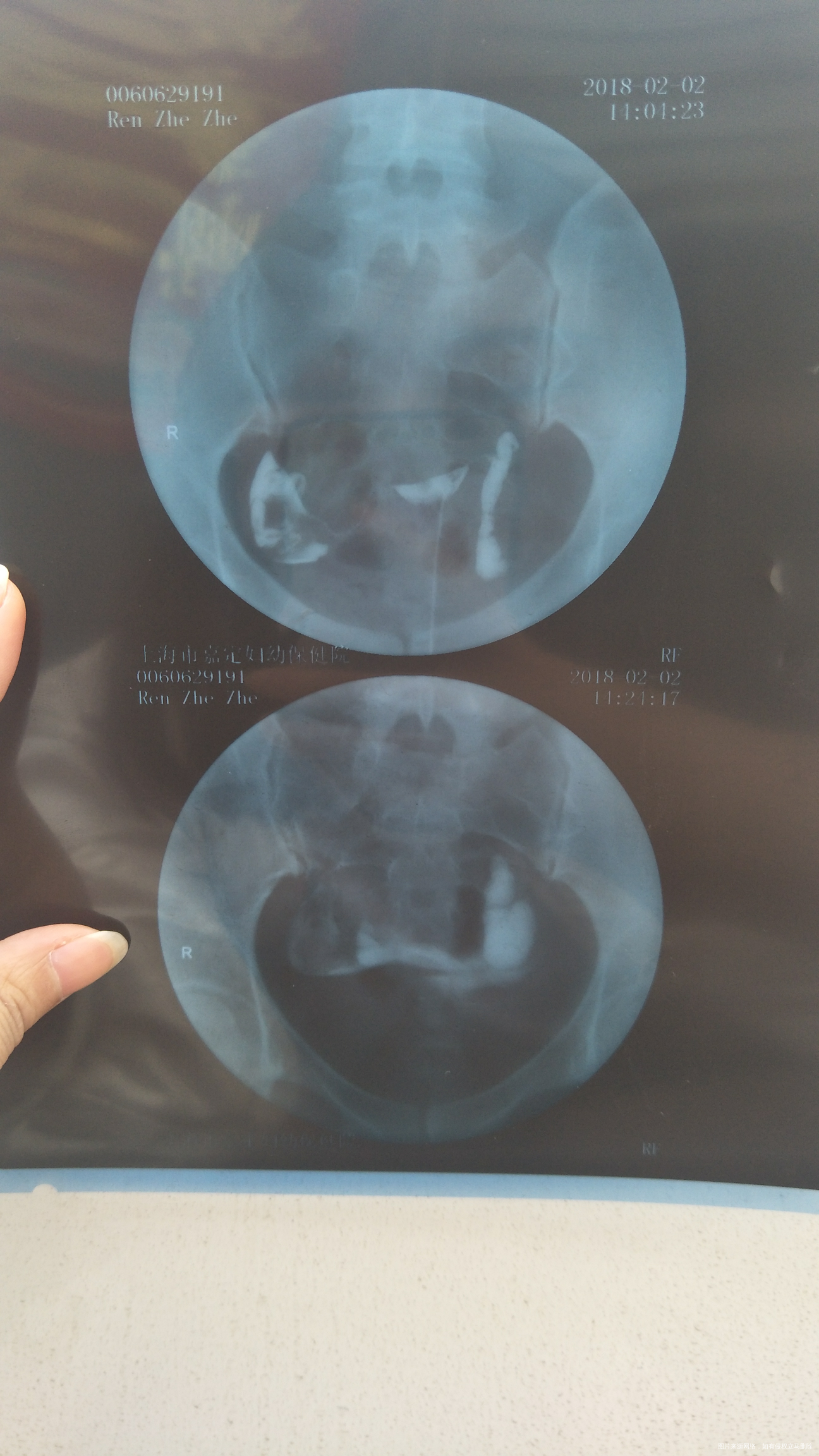 帮忙看下造影片,凑字凑字凑字