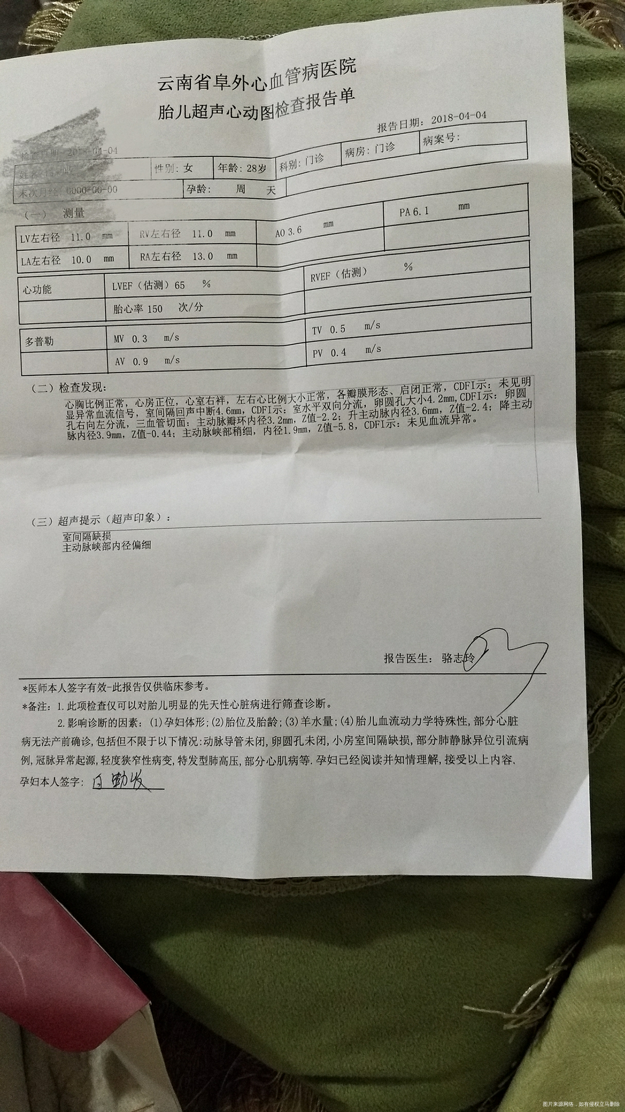 主动脉峡部内经偏细是什么意思?