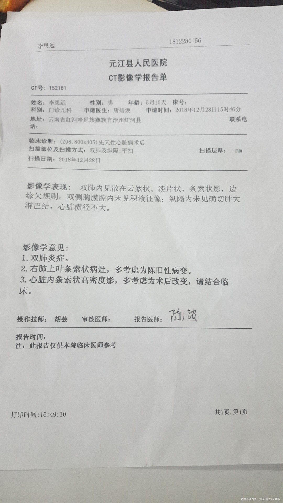 急急急,这边医生说肺炎很严重,叫我去昆明儿童医院看看