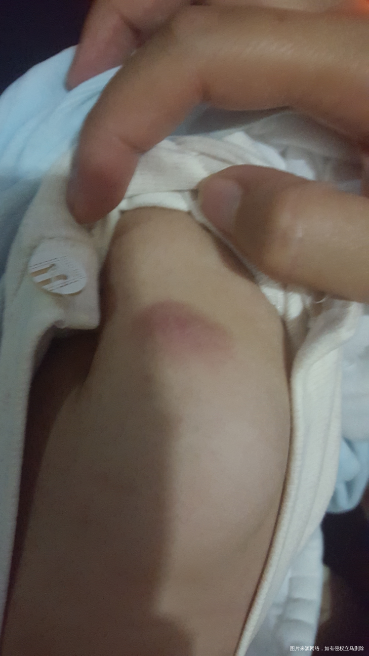 求助宝宝现在五个多月,两个月的时候打预防针