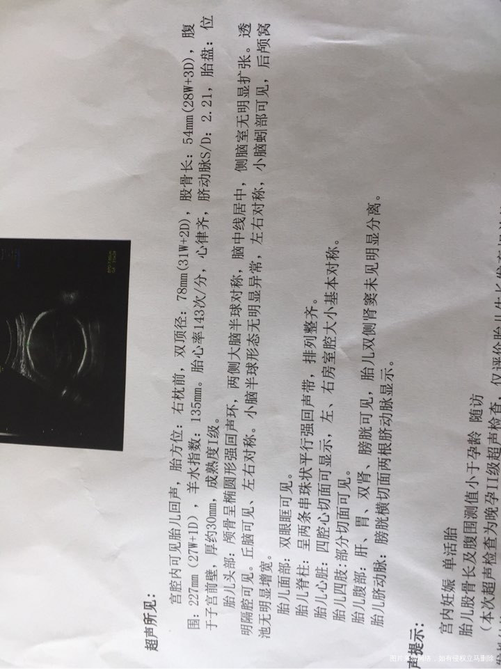 孕31周,宝宝偏小,怎么办?