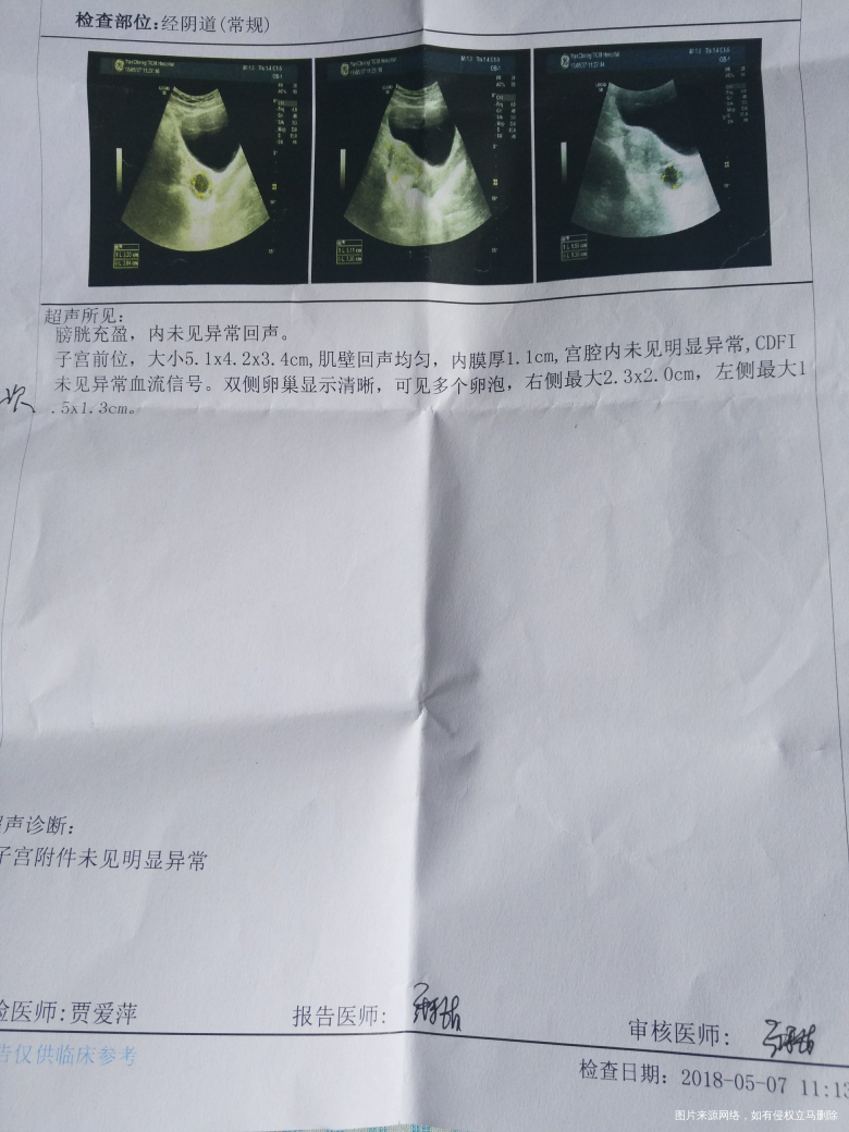 医生您好,卵泡今天监测2.3*2.0,打了三只绒促性素,我什么时候同房好呢