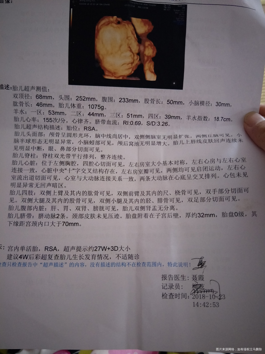 可能真是听了ta爸的话吧?!真是个自信的宝宝,知道照相就赶快露脸了,12分钟就搞...