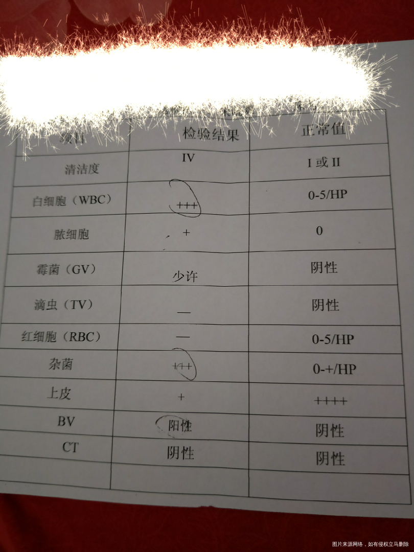 今天做了白带检查,白带有点不正常,