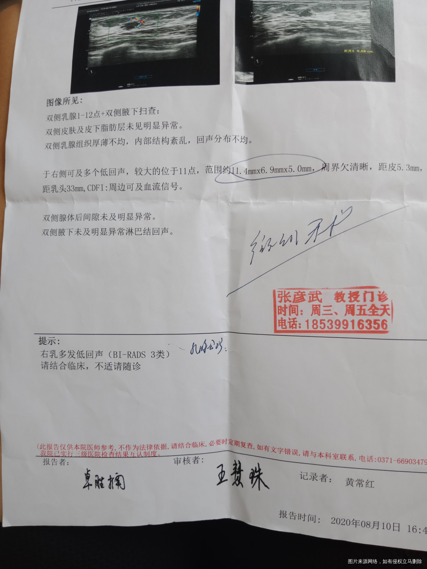 乳房有结节影响试管婴儿吗