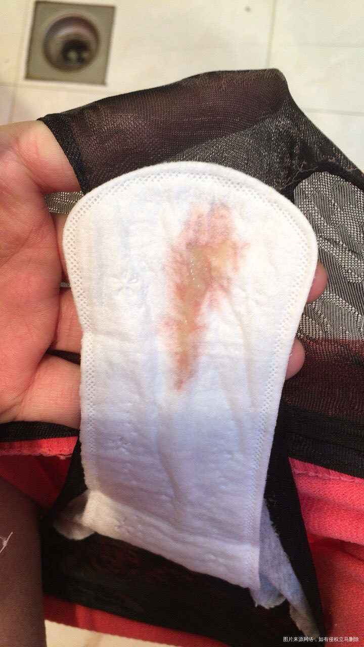 怀孕38周,是不是见红了