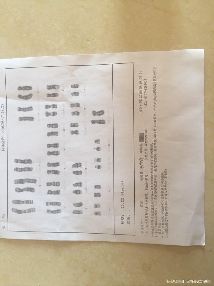 帮我看看这个染色体正常不