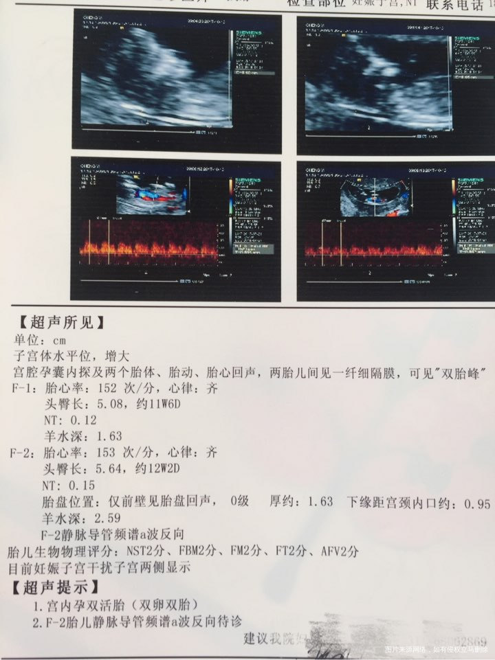 期待各位医生主任的回复!