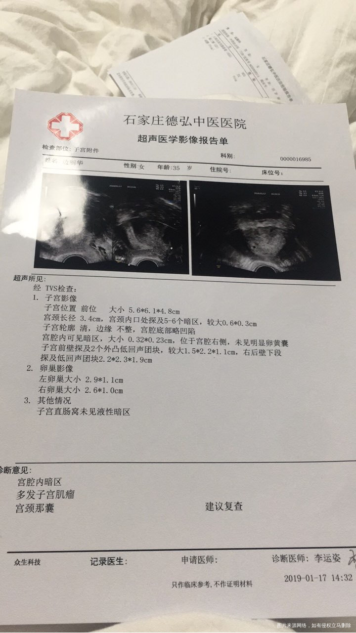 试管移植冻胚第18天,HCG血脂5400