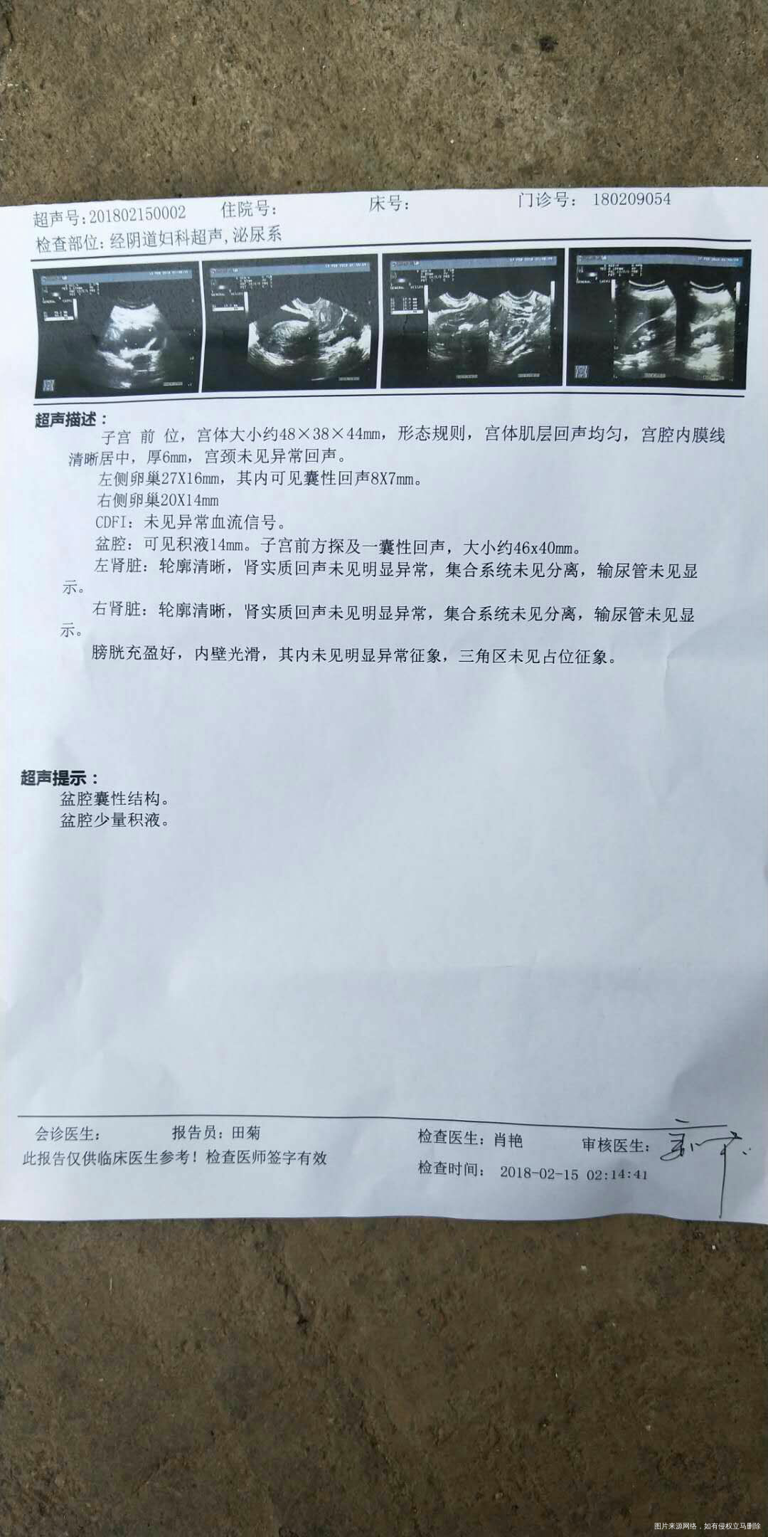 请在线的医生 帮帮忙 看看