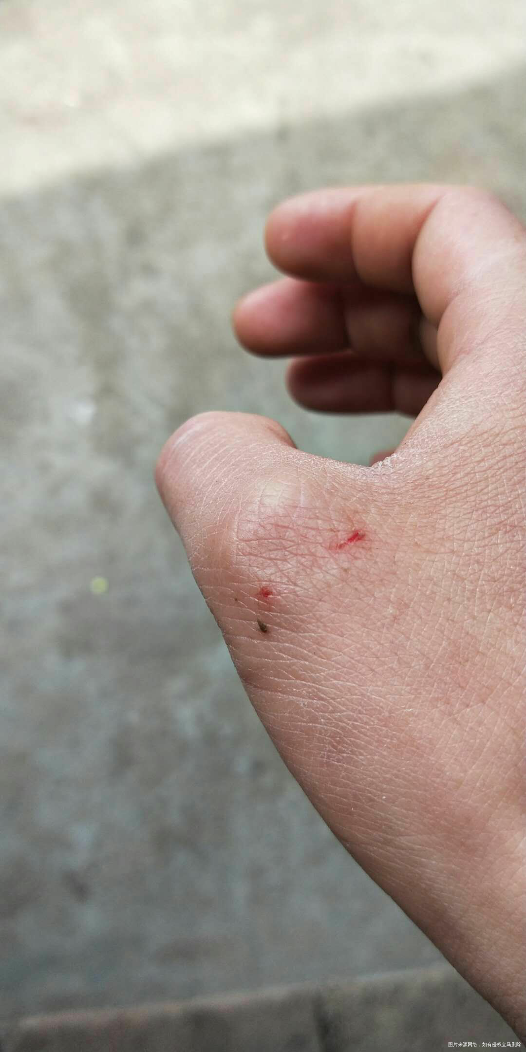 请在线的医生帮忙看看