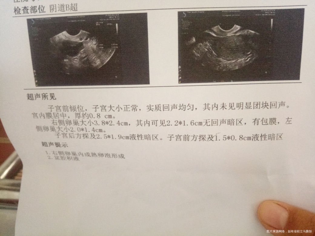 在线的医生帮帮忙看看