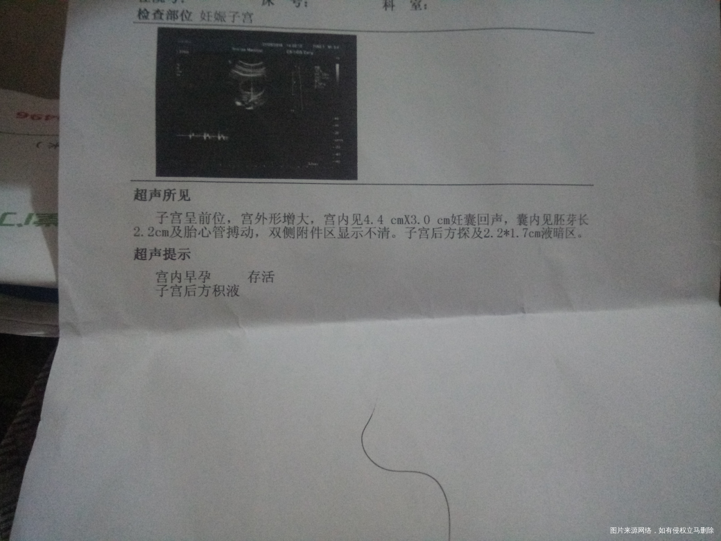 在线的医生帮帮忙看看 这结果