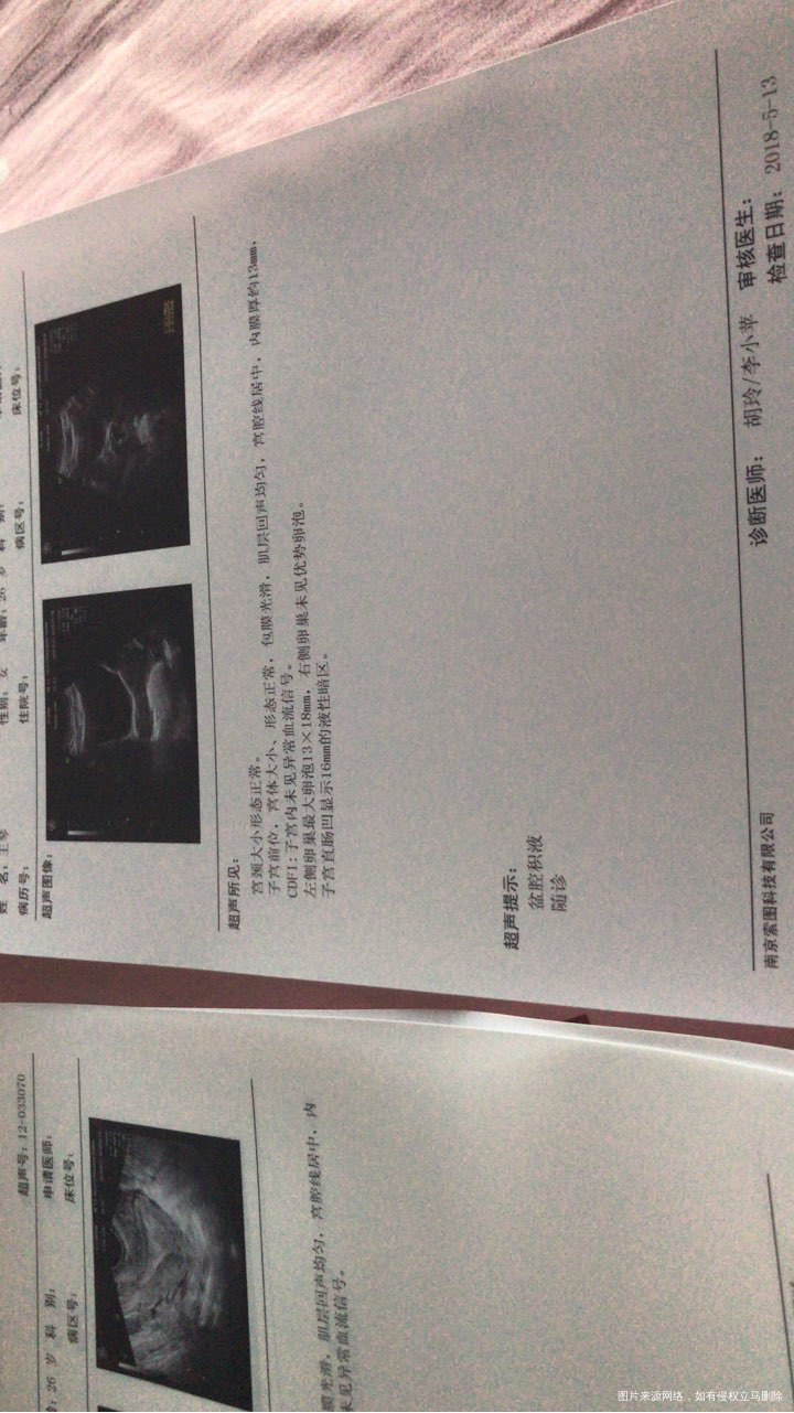 我想问下这是排卵了还是没排呢?