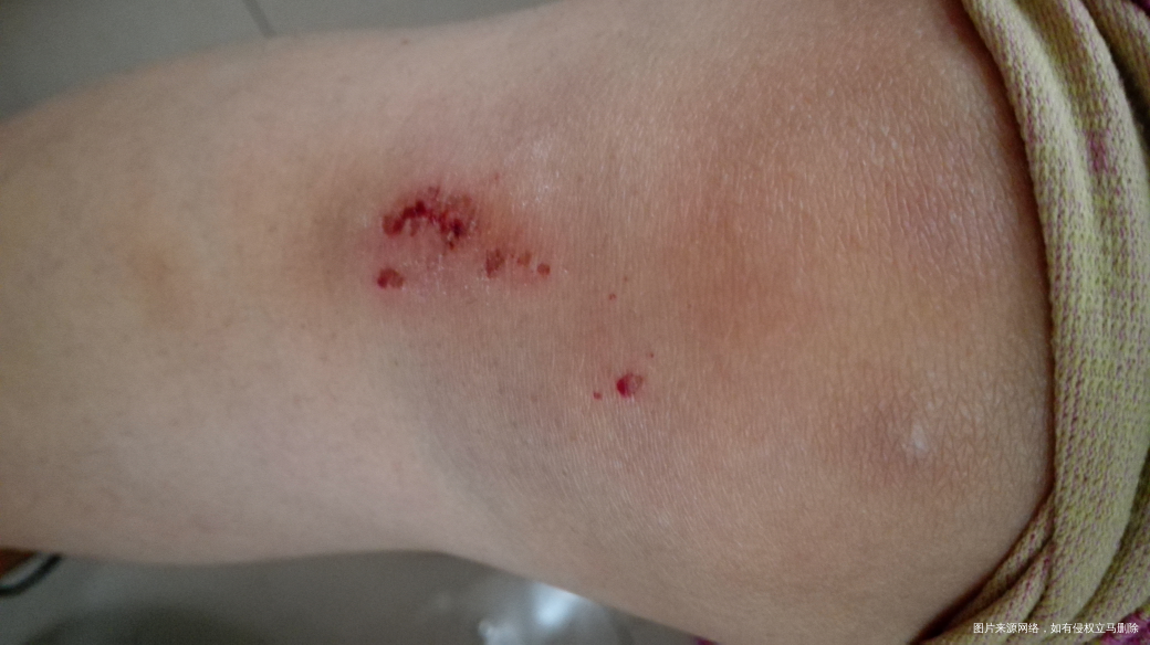 经历飞车之险,更加珍爱生命