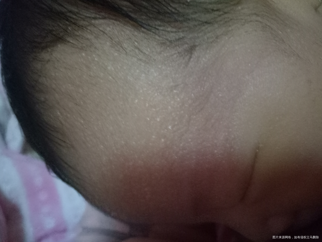 八天的宝宝,医生帮忙看看