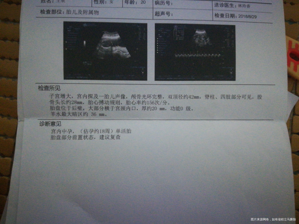 怀孕四个多月,胎盘部分前置