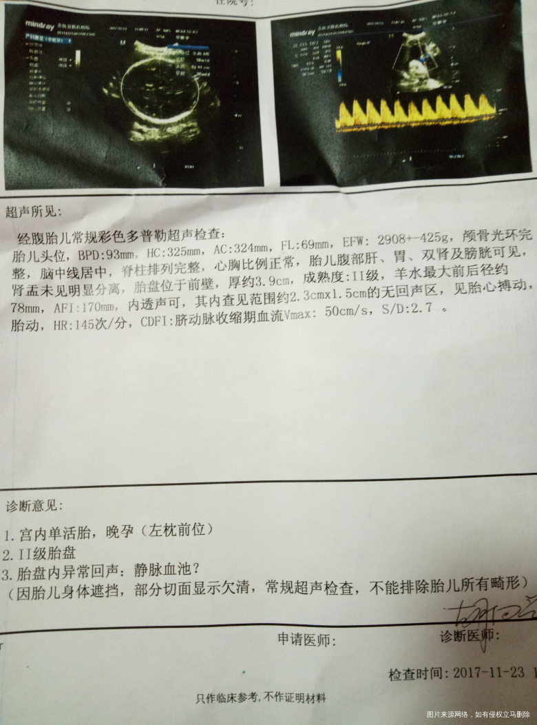 急,急,有医生在吗?快帮我看看