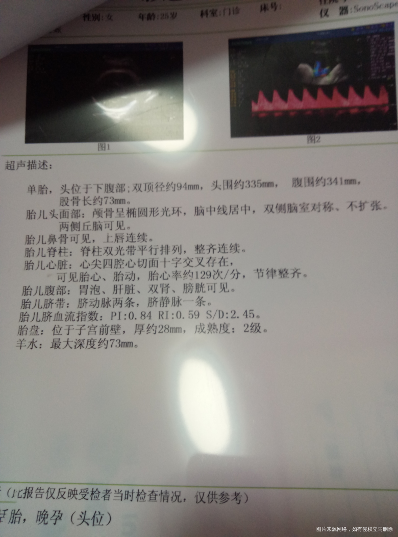 急,有医生在吗?能帮我看看孩子有多大